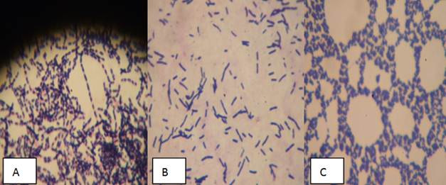 Corynebacterium glucuronolyticum. Corynebacterium SPP У мужчин. Corynebacterium glucuronolyticum норма. Коринебактериум глюкоронолитикум. Взаимодействие Бациллус Мегатериум с растениями.