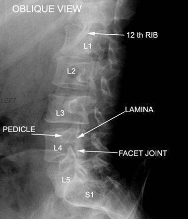 Lumbar Spine X Ray Anatomy